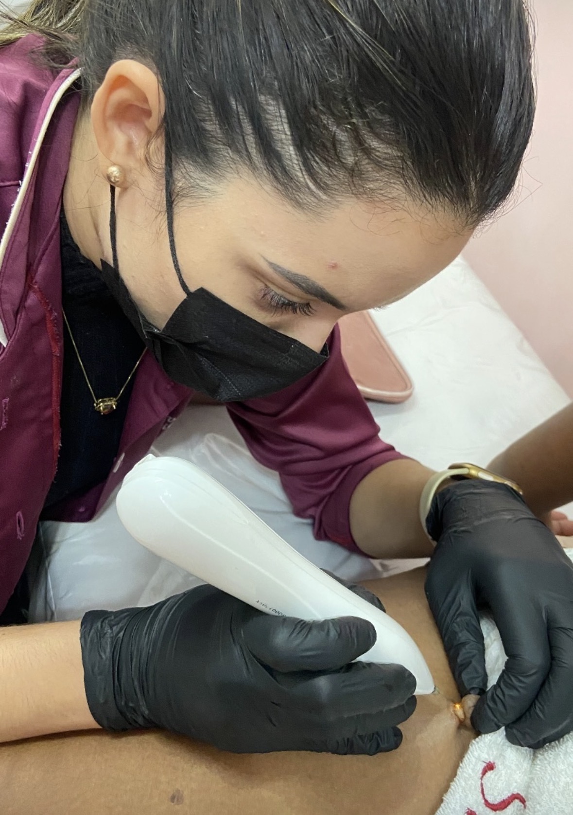 Remoção de sinais 