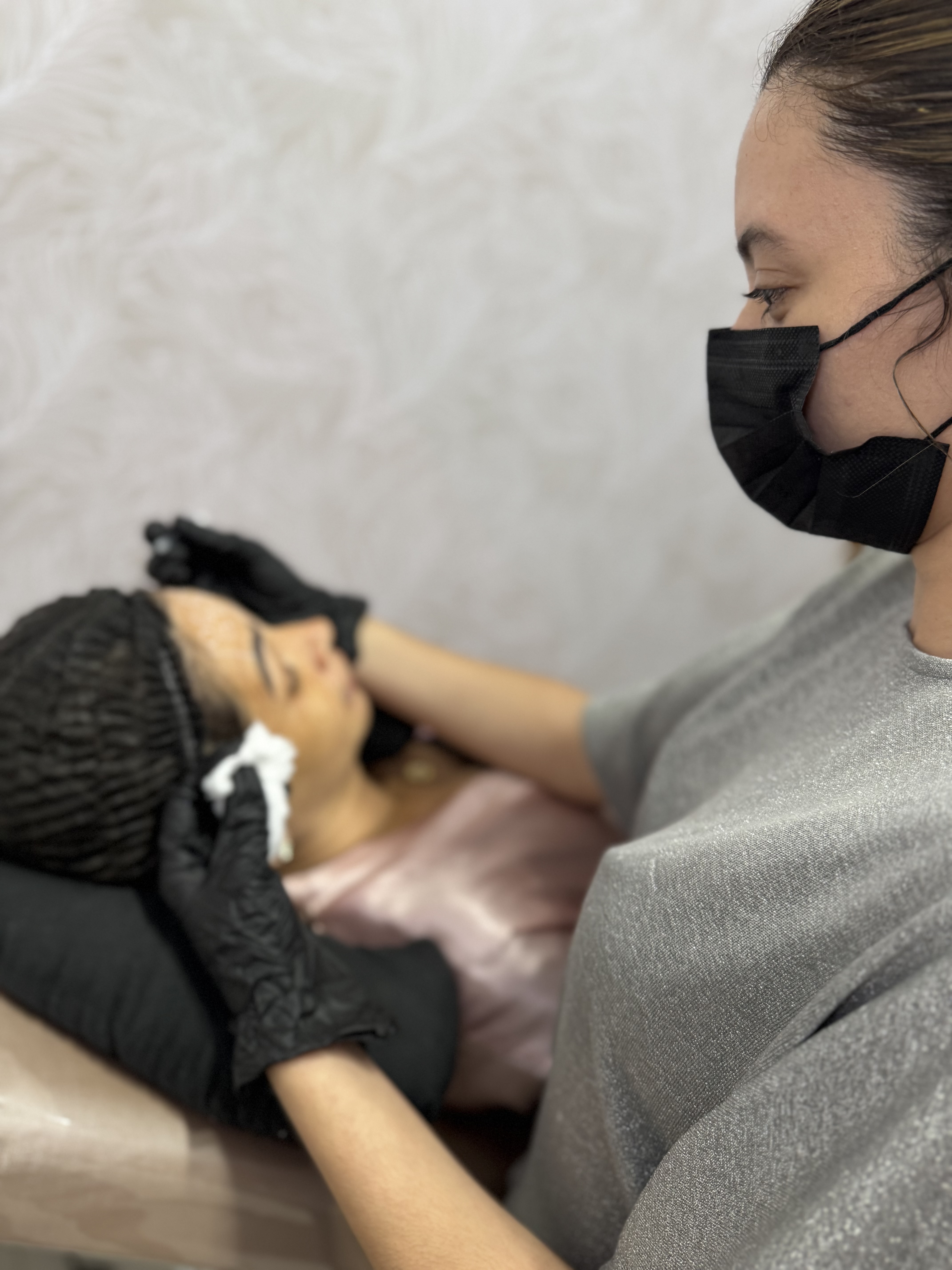 Sessão de PDRN microagulhamento facial 